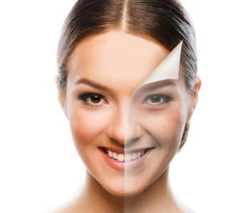 Chemical Peels in Mountain View