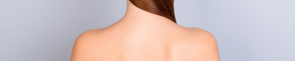 Laser hair removal