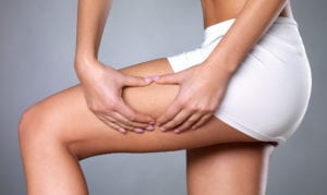 Cellulite reduction Mountain View