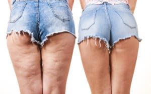 istock 997619988 300x188 1