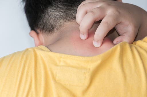 rashes rashes