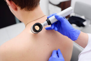 SkinCancerCheck