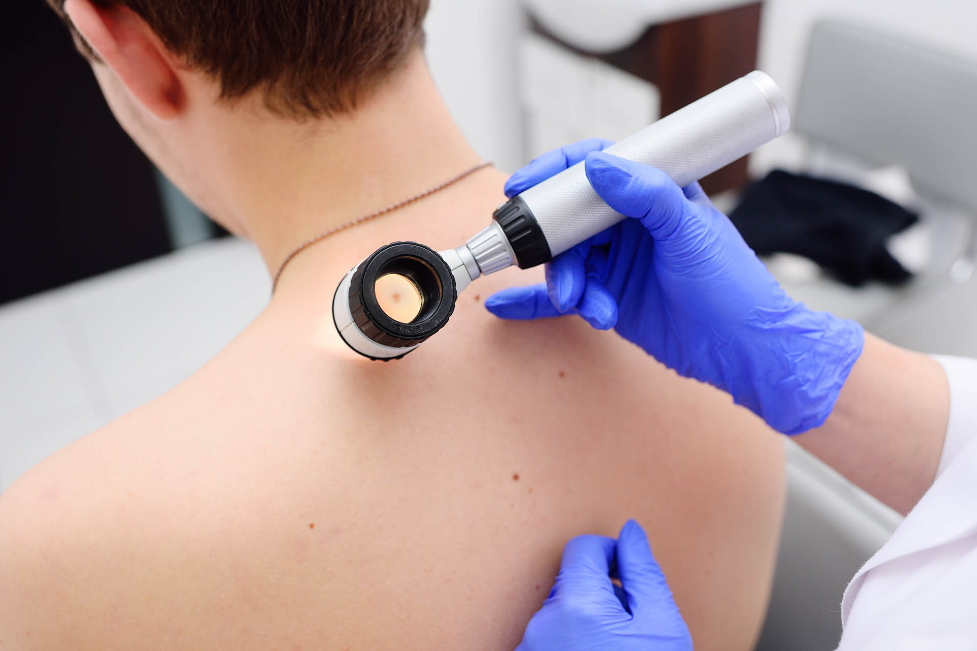 SkinCancerCheck