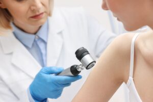 Dermatologist,With,Dermatoscope,Examining,Patient,In,Clinic,,Closeup