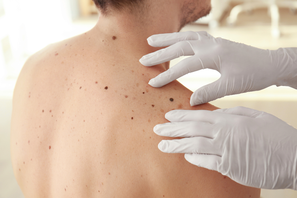 Dermatologist,Examining,Patient,In,Clinic