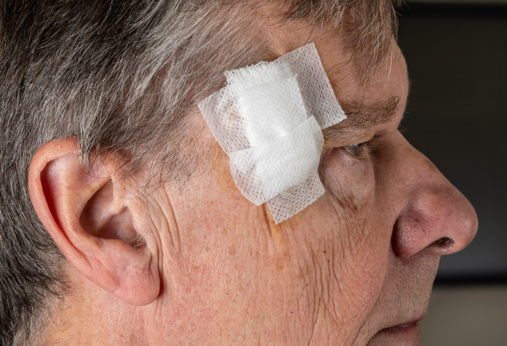 Senior,Adult,Male,With,Dressings,On,Surgery,For,Removal,Of