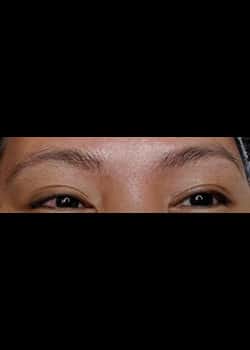 Microblading